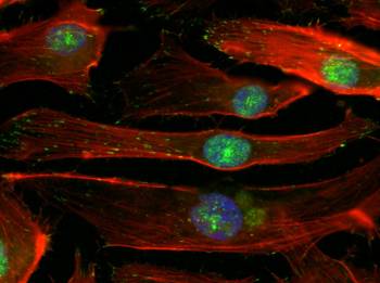 Améliorer le traitement des maladies cardiovasculaires à l'aide d'endoprothèses biomimétiques